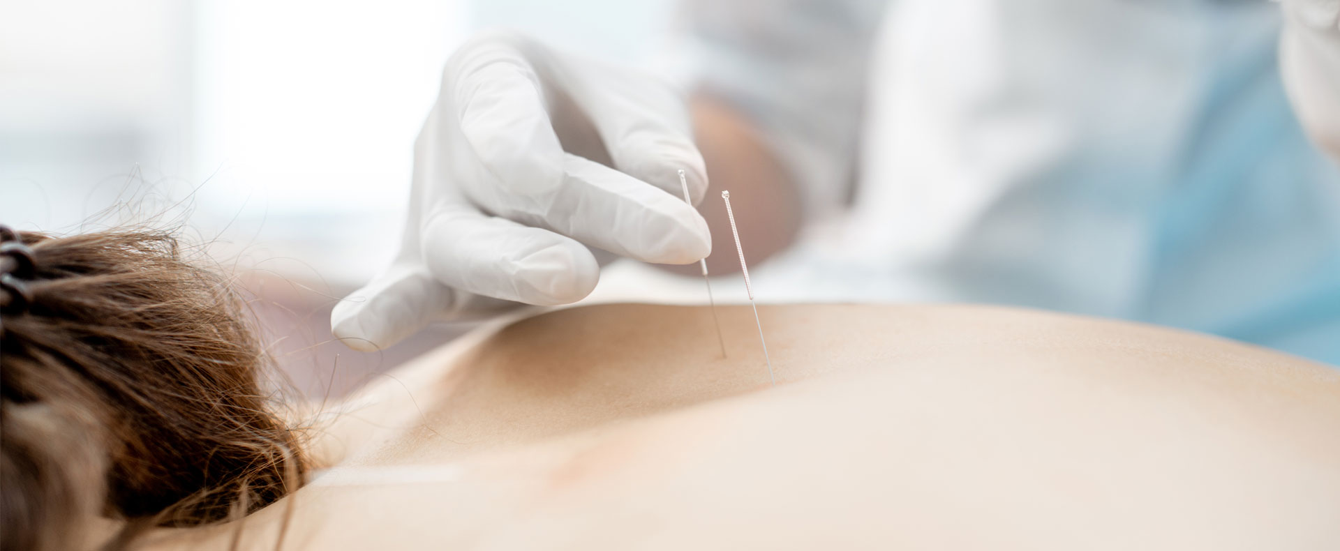 Βελονισμός και χειροπρακτική